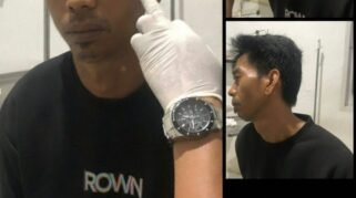 Korban penganiayaan oknum RT di Mamuju Tengah menunjukkan luka lebam di wajah